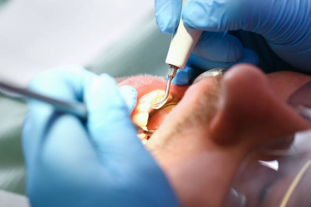 Best Emergency Dental Surgery in Bellevue, MI